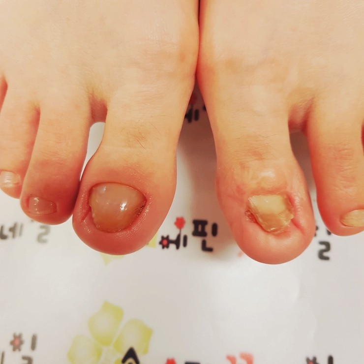 손꽃네일 이미지