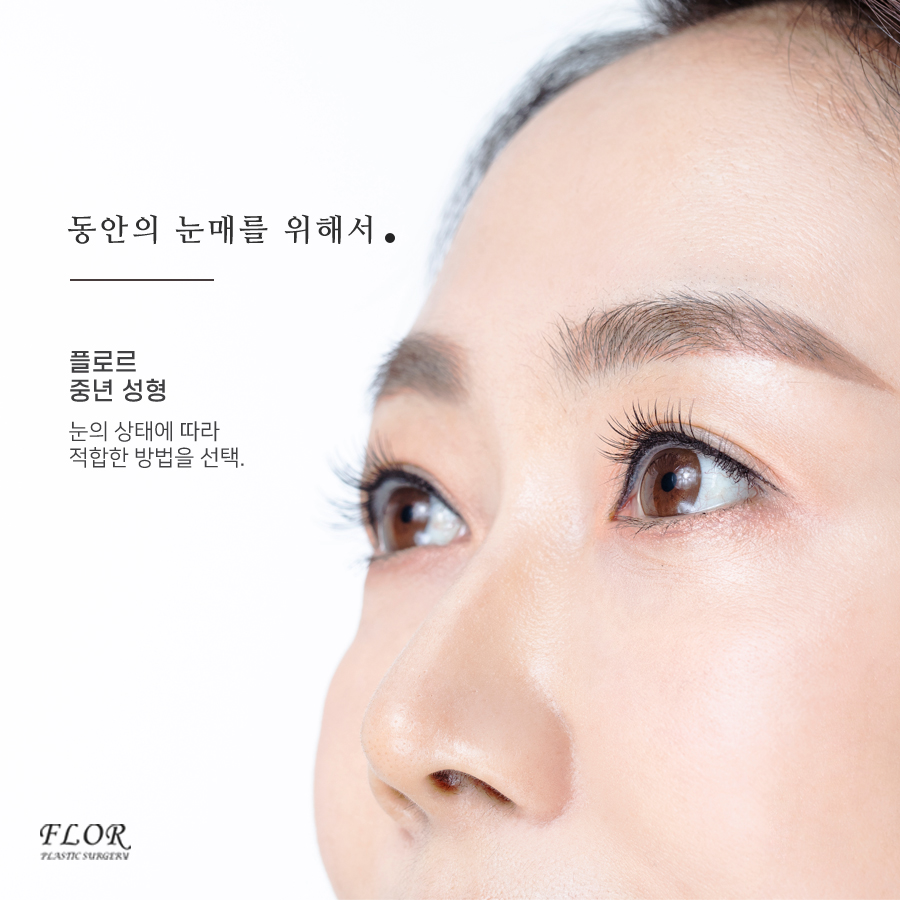 플로르성형외과 이미지