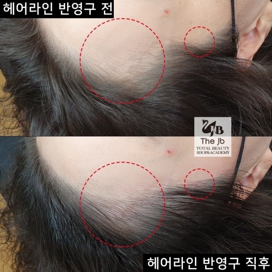 제이비라인 이미지