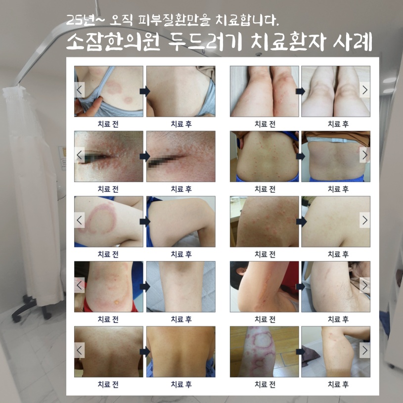예진피부 이미지