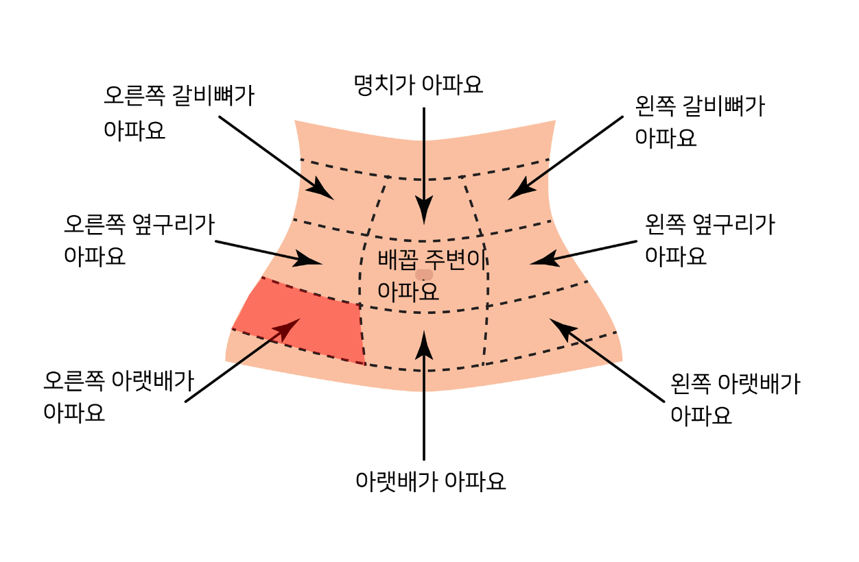 윗배 더부룩함 : 지식iN