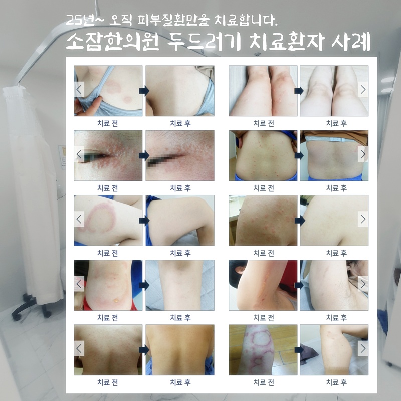 예진피부 이미지
