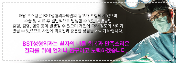 비에스티성형외과의원 이미지