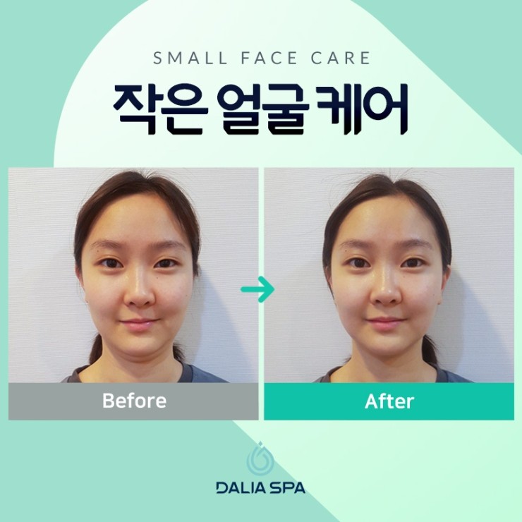 약손스킨케어 이미지