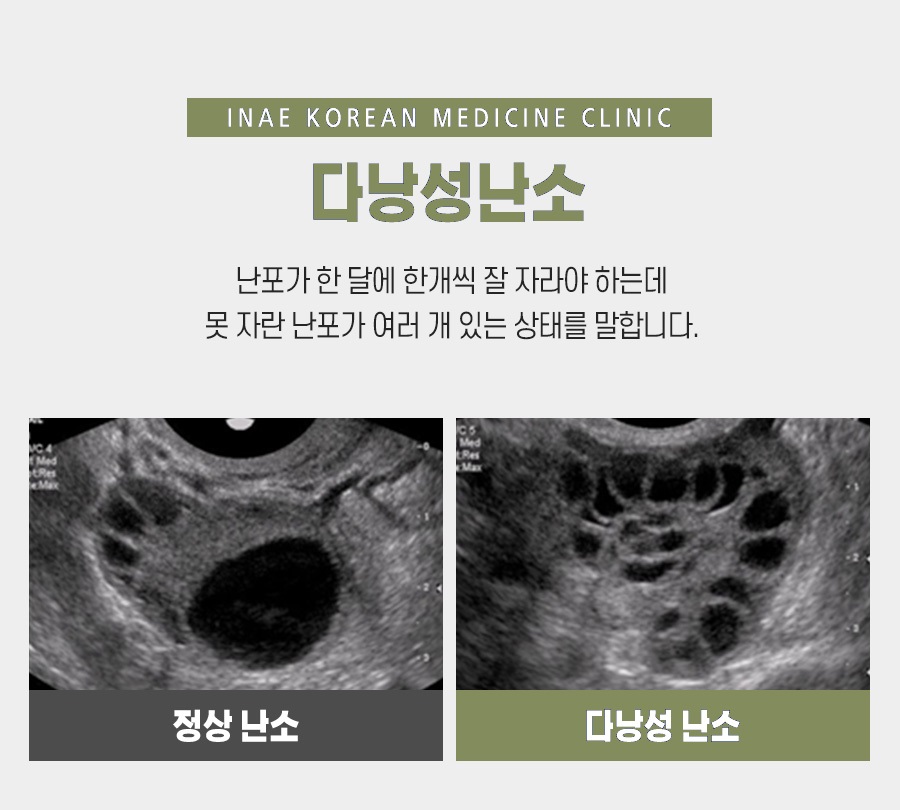 김포튼튼한의원 이미지