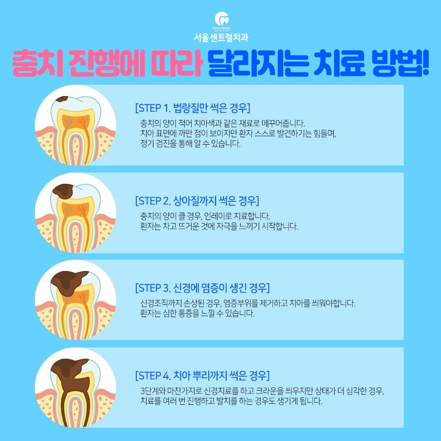 서울센트럴치과 이미지