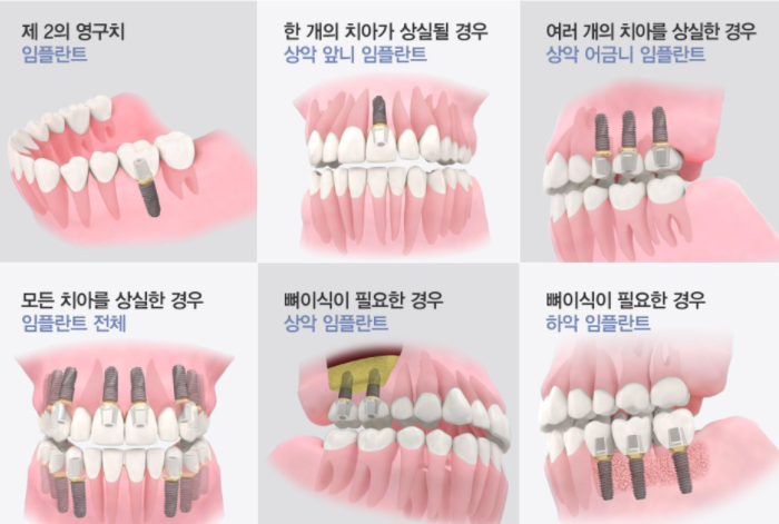 참좋은부부치과 이미지