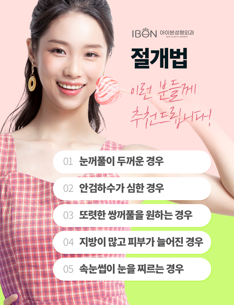 아이본 이미지