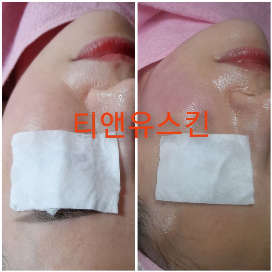 스킨업 이미지