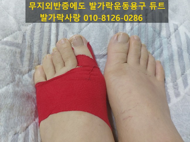 용구반점 이미지