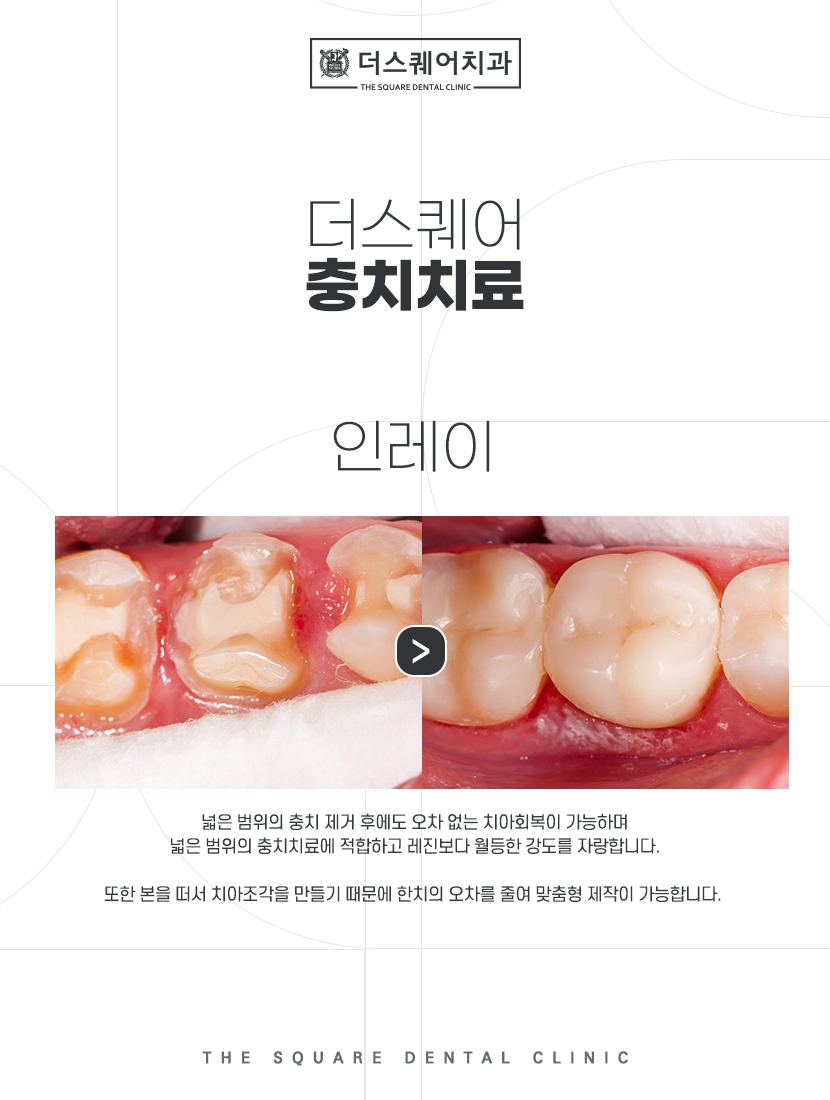 금이랑은이랑 이미지