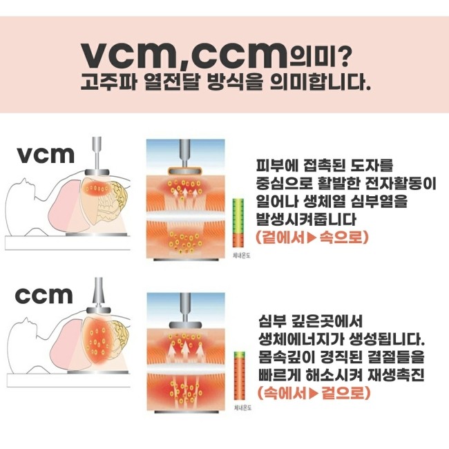 뉴비스 이미지