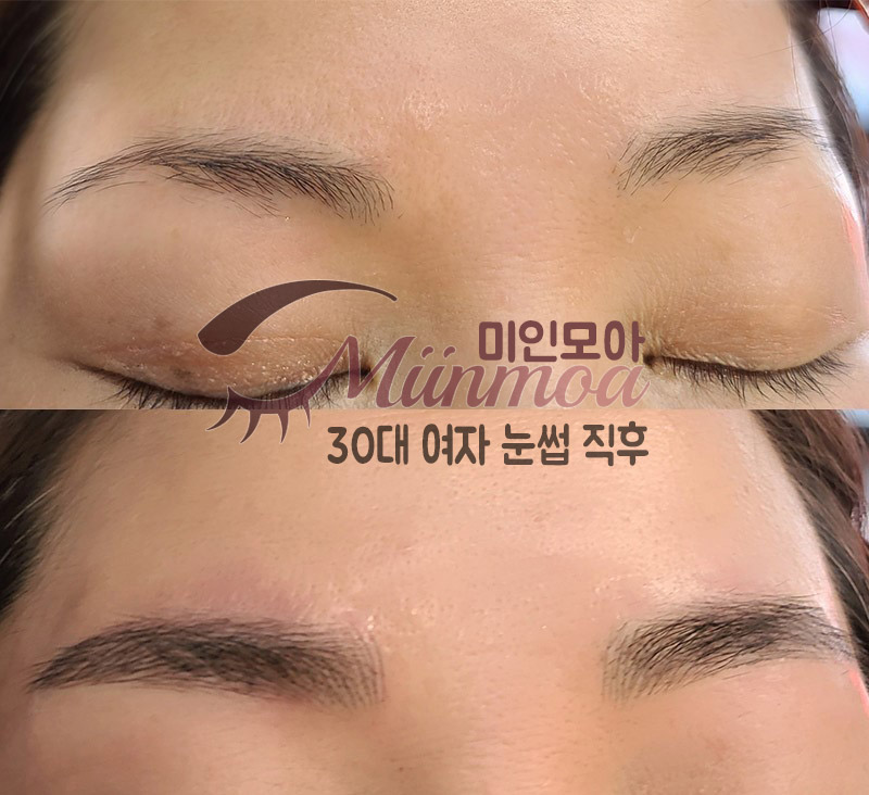눈썹짱 이미지