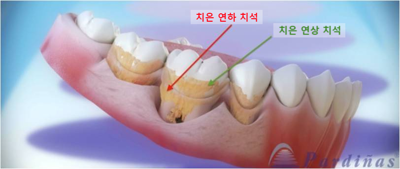 미사센트럴치과 이미지