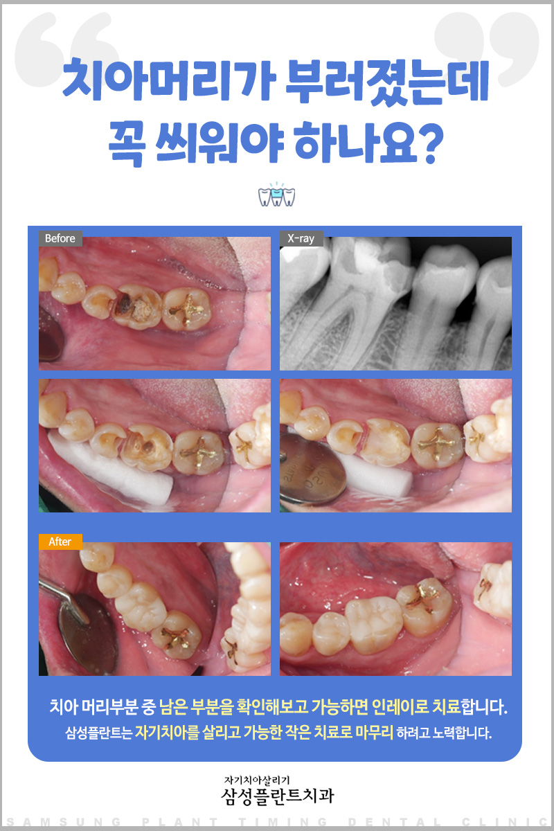 삼성플란트치과의원 이미지