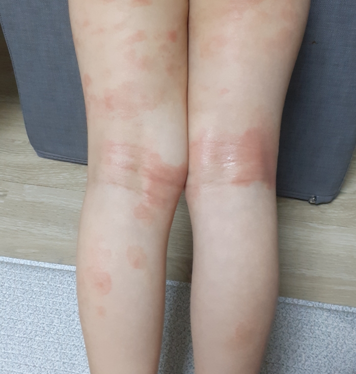 인사랑한의원 이미지