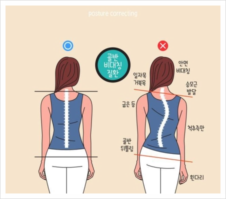 아르떼발레 이미지