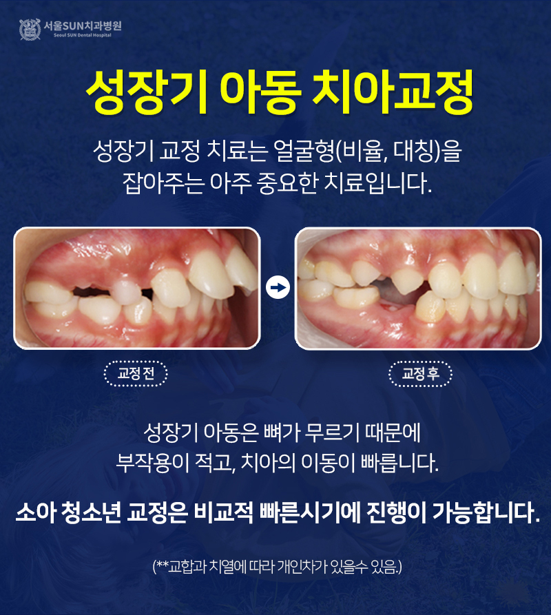 서울아이치과 이미지