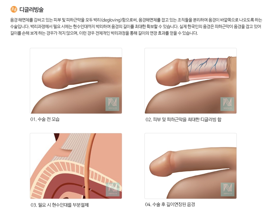 강남피부비뇨기과의원 이미지