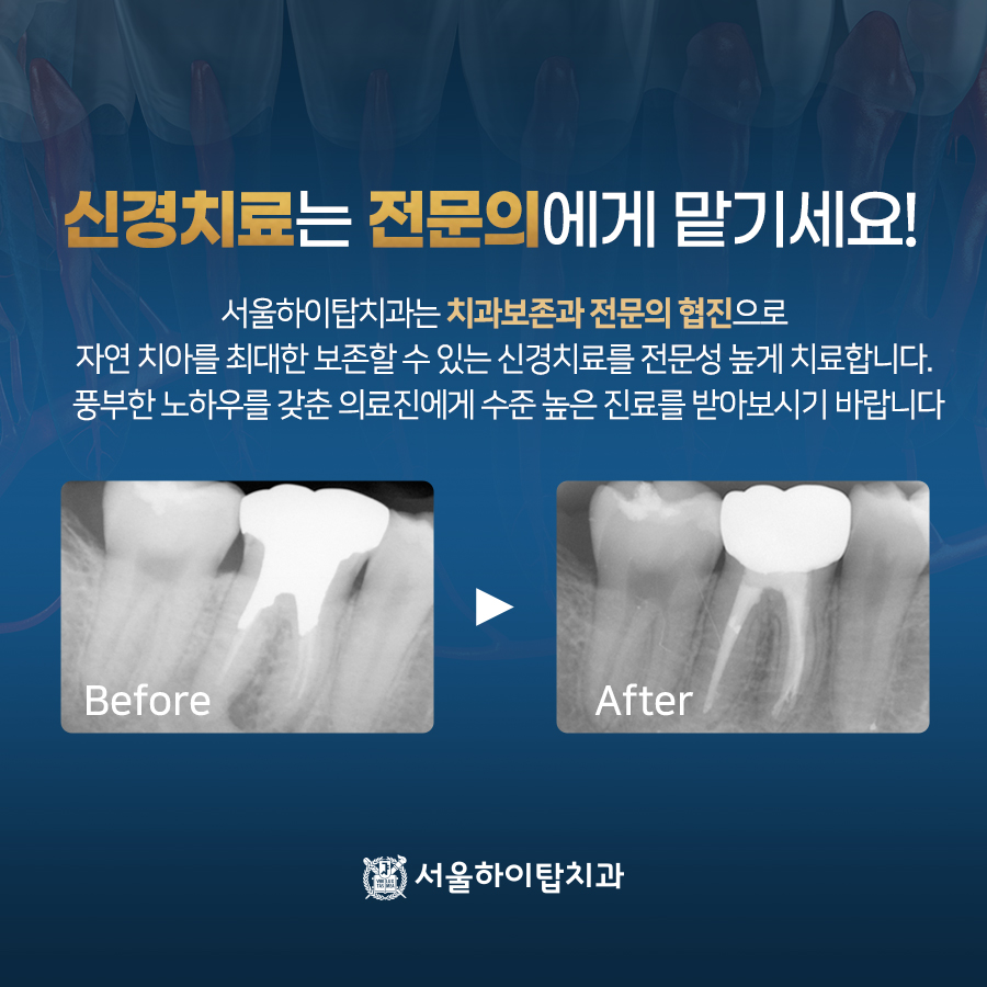 서울하이치과 이미지