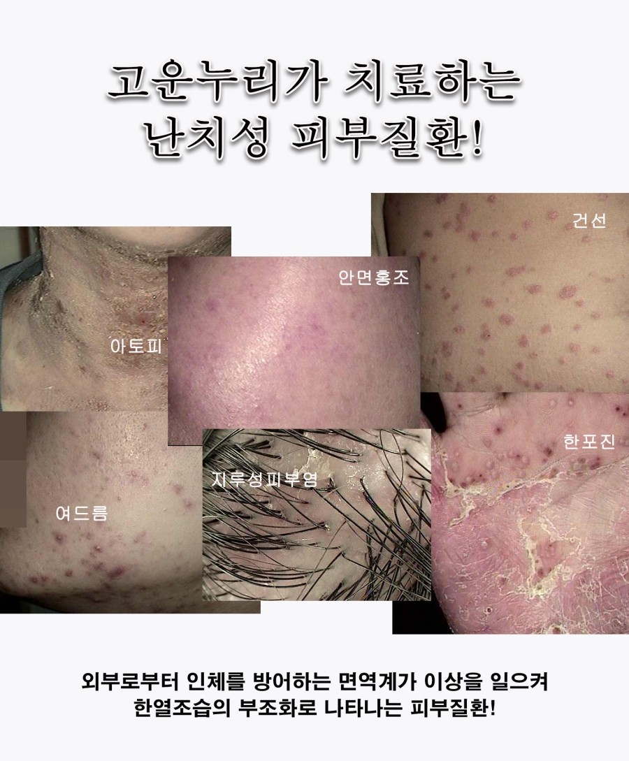 누리한의원 이미지