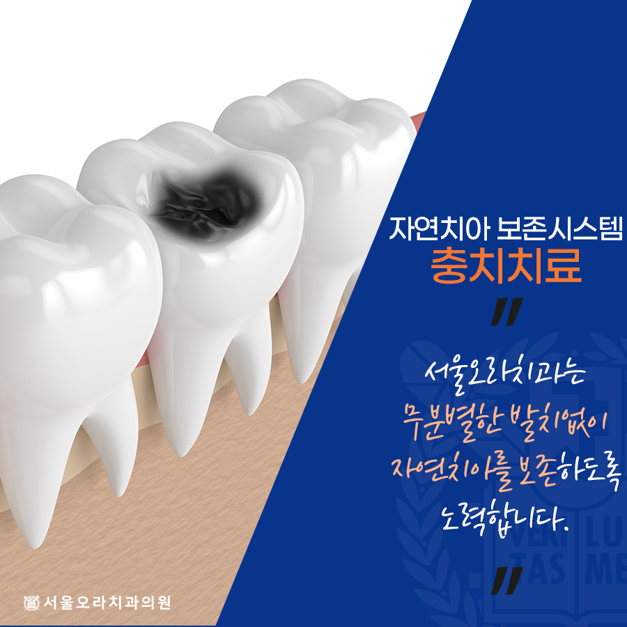 서울오라치과 이미지