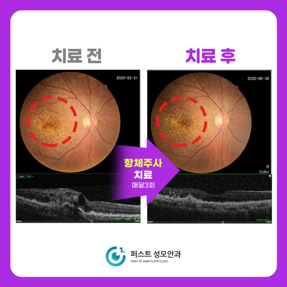 더퍼스트성모안과 이미지
