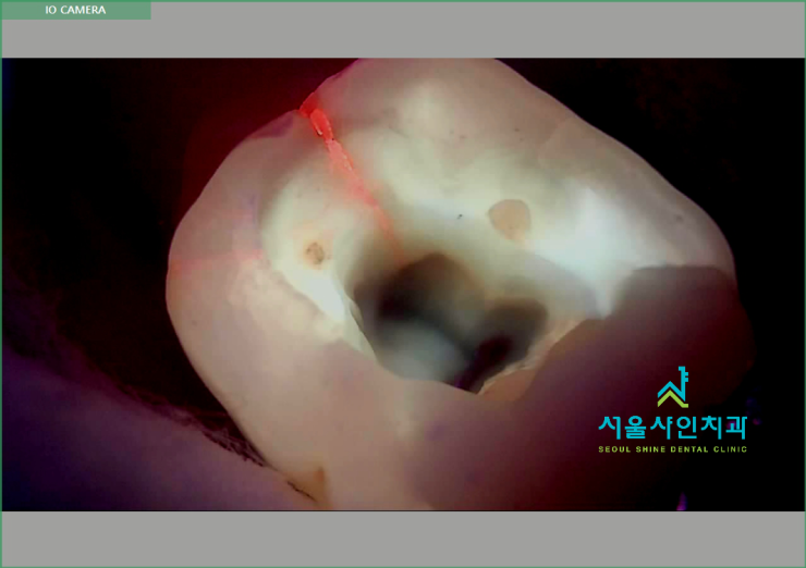 청담엔샤인의원 이미지