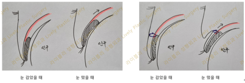 라이블리성형외과의원 이미지