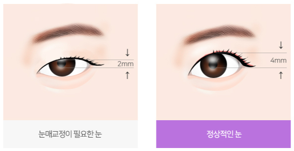 꼼꼼성형외과의원 이미지