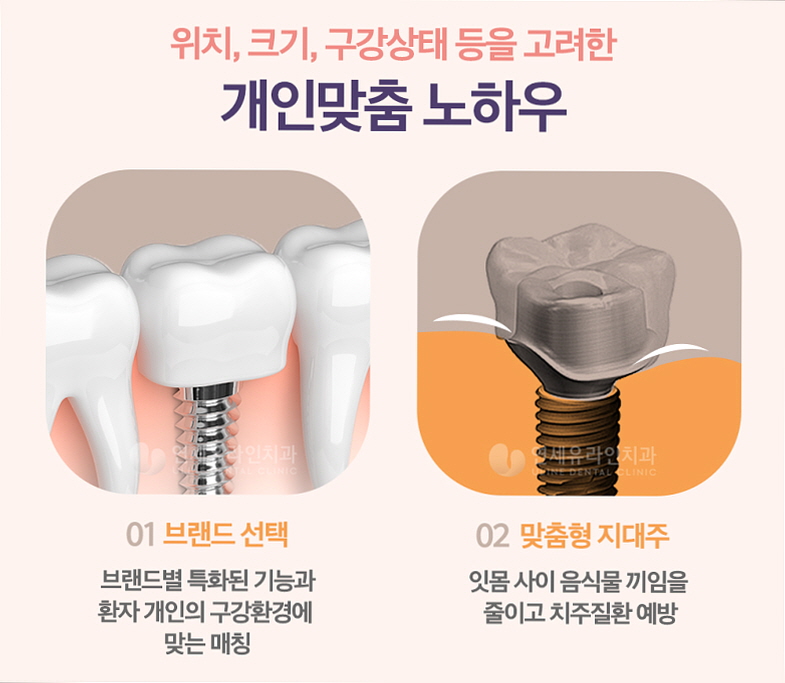 틀치과의원 이미지