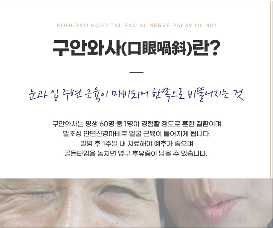 안면에어컨 이미지