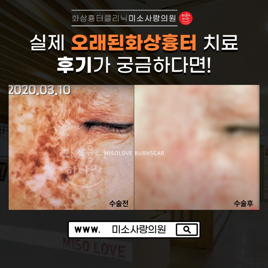 미소사랑의원 이미지