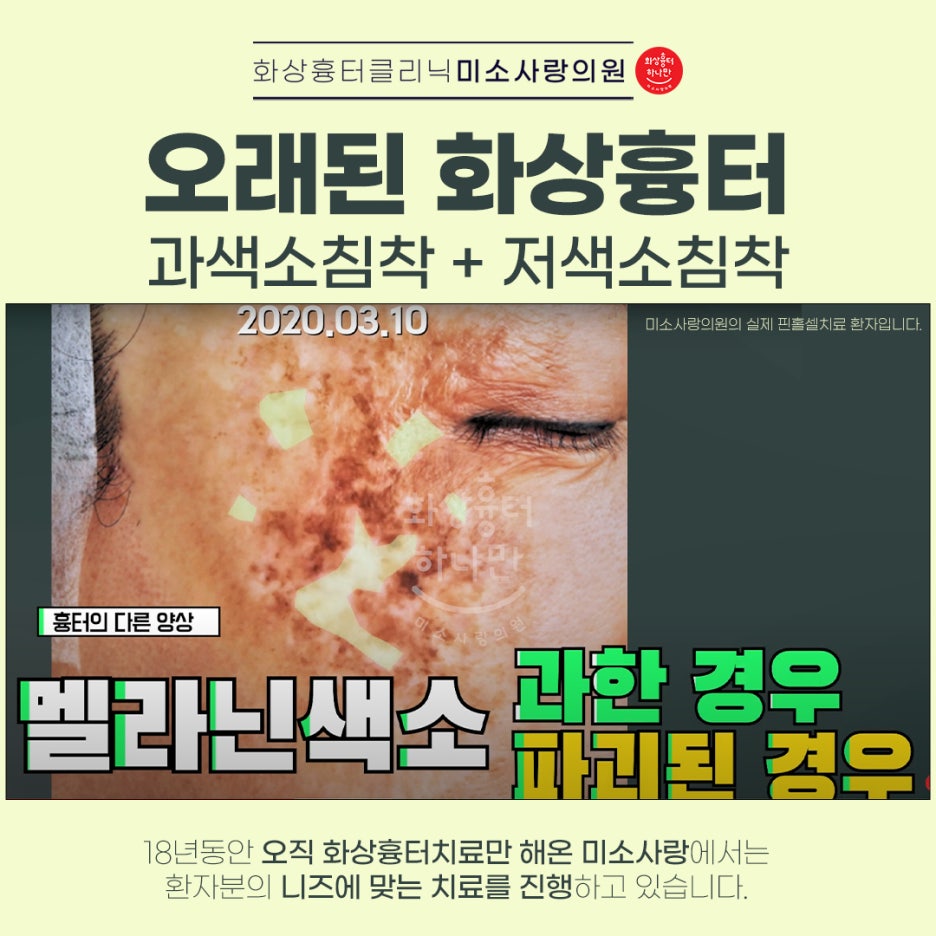 미소사랑의원 이미지