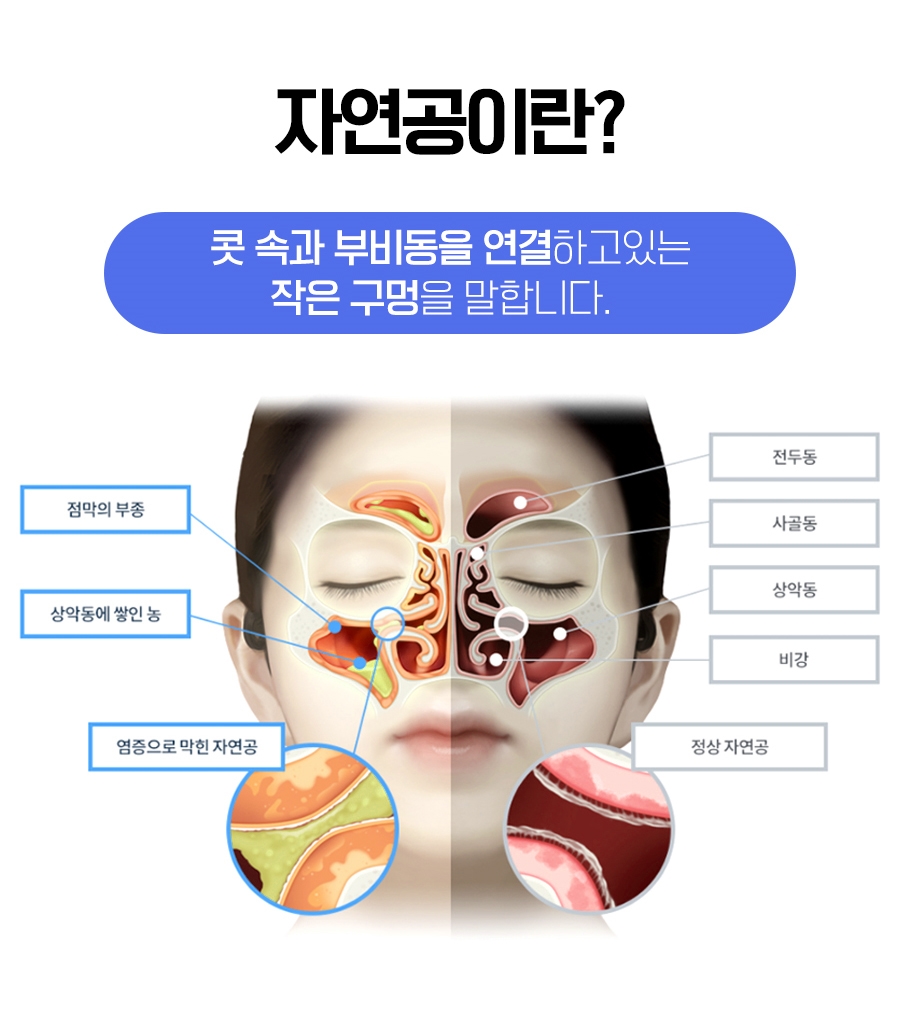 올림pick (@olympick_shop) • Instagram photos and videos, image size:900x1019