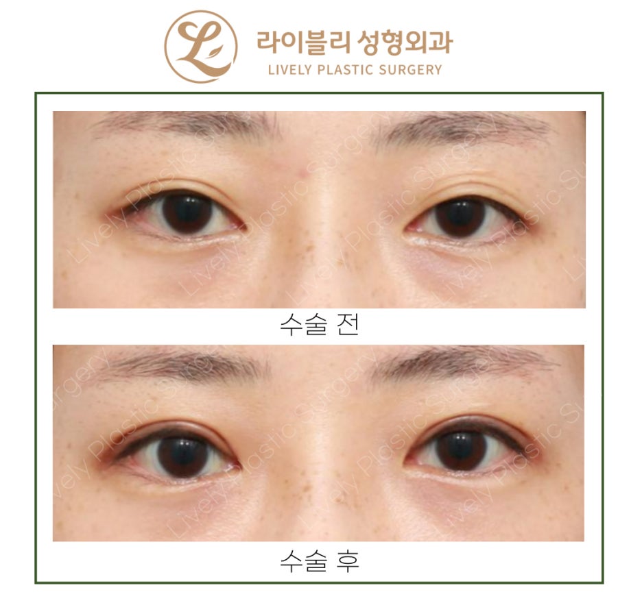 라이블리성형외과의원 이미지