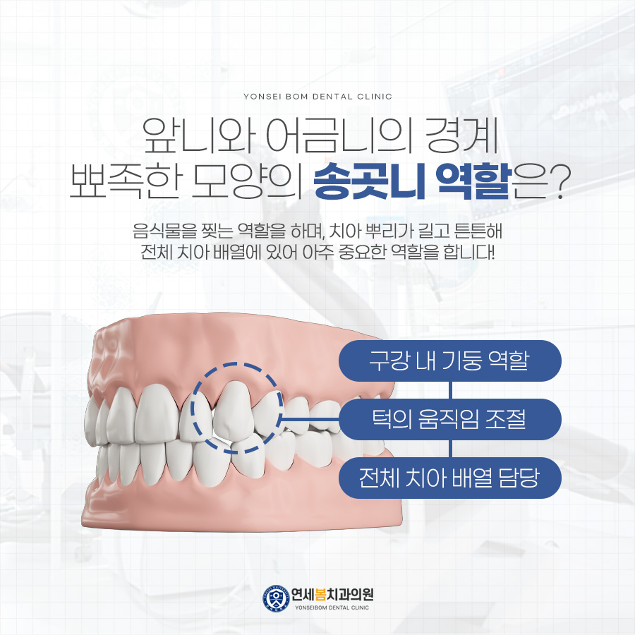 부산송곳니충치 초기라면 당일레진으로! : 네이버 블로그, image size:900x900