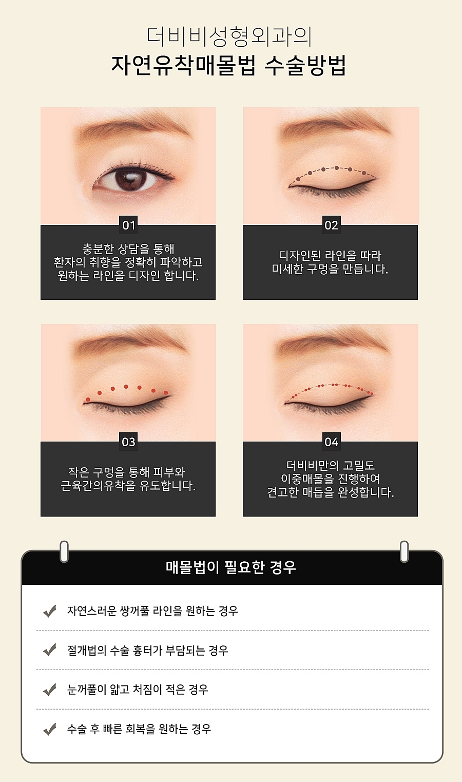 티포인트성형외과의원 이미지