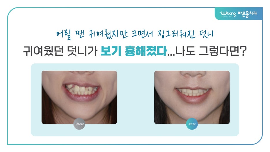 바른웅치과의원 이미지
