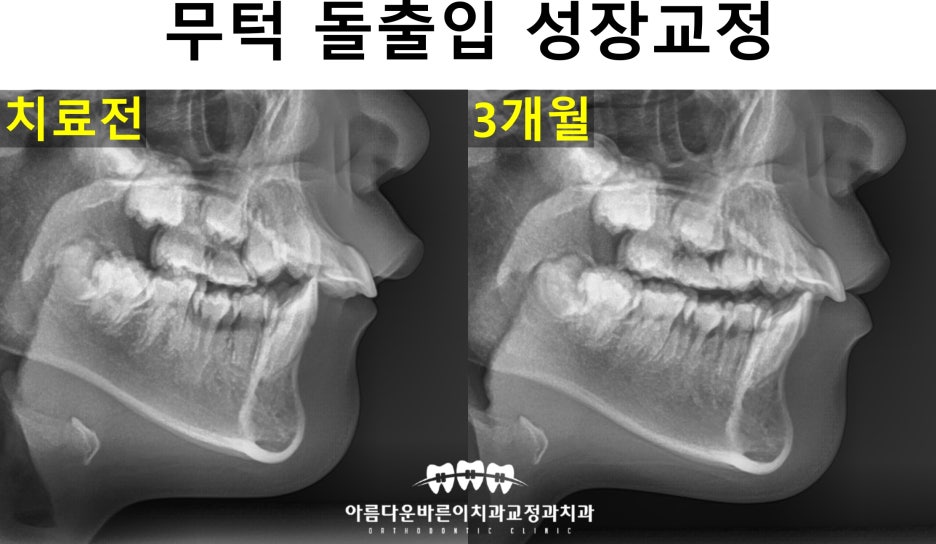 아름다운차이치과 이미지