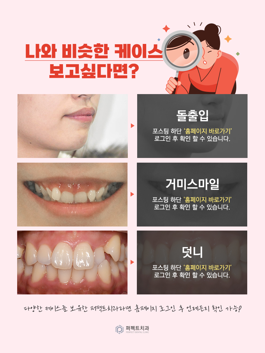 심플교정 이미지