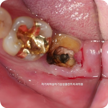 삼성플란트치과의원 이미지