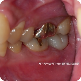 삼성플란트치과의원 이미지