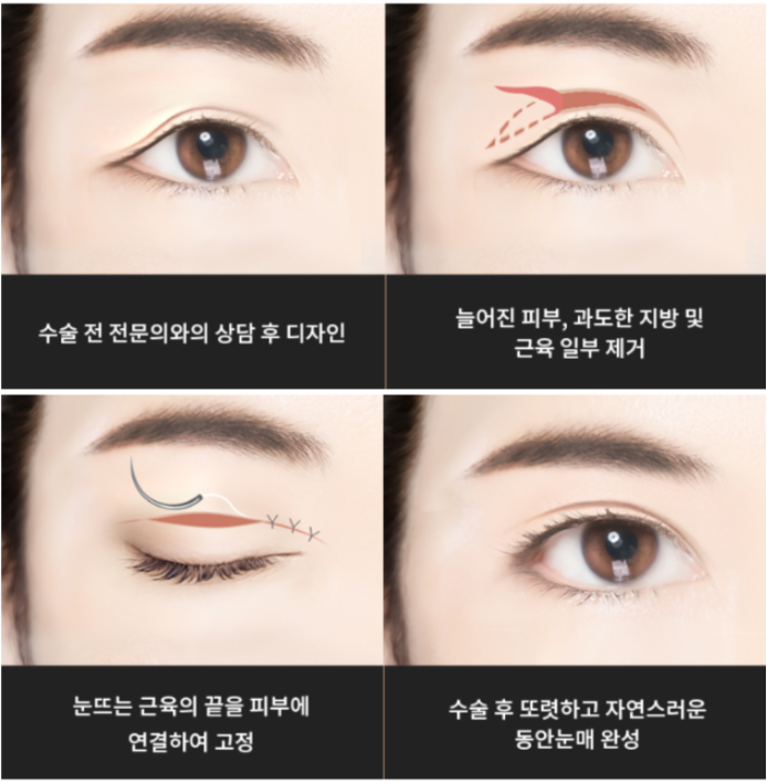 라이블리성형외과의원 이미지