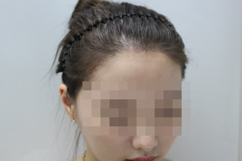 헤어콕 이미지