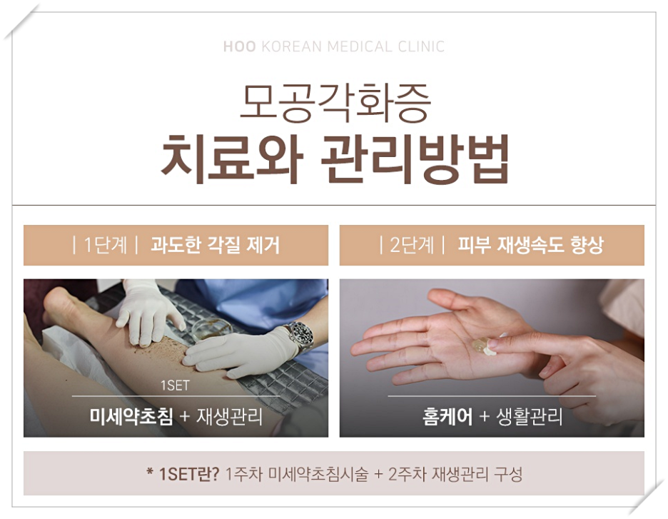 원주약초 이미지