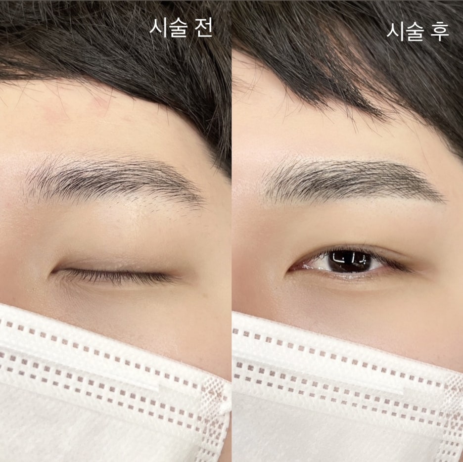 리메이드 이미지
