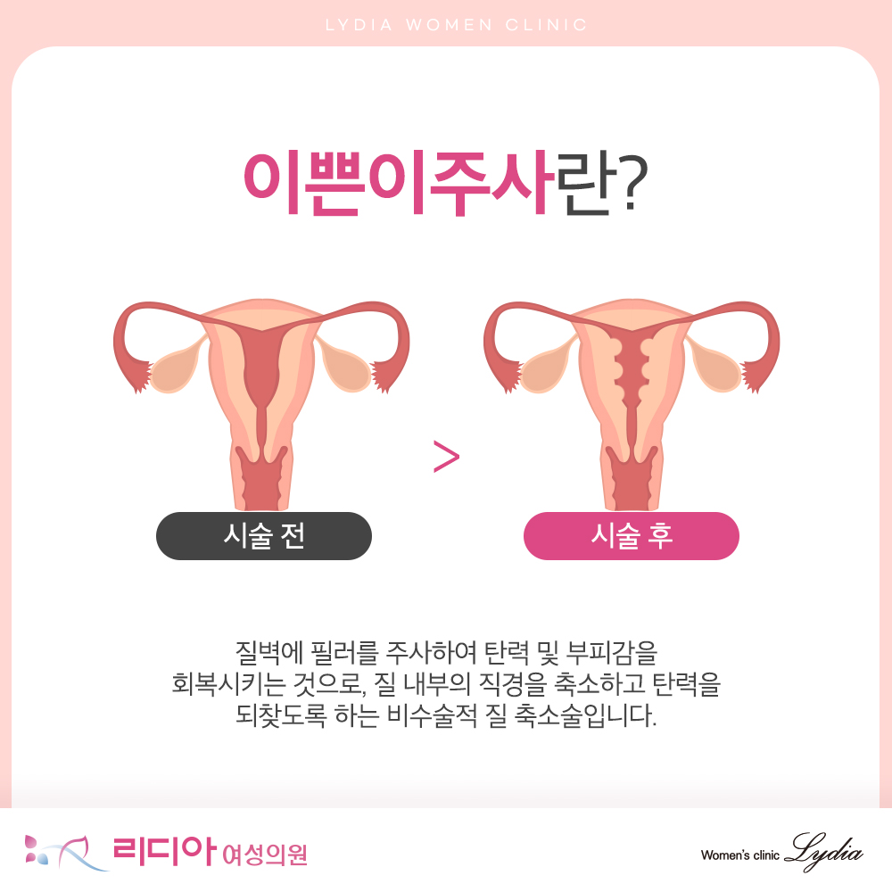 강남질필러 고민 전 여성 Y존 변화와 섬세한 관리 필요성 기본 확인 사항