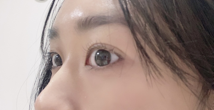 티니네일 이미지