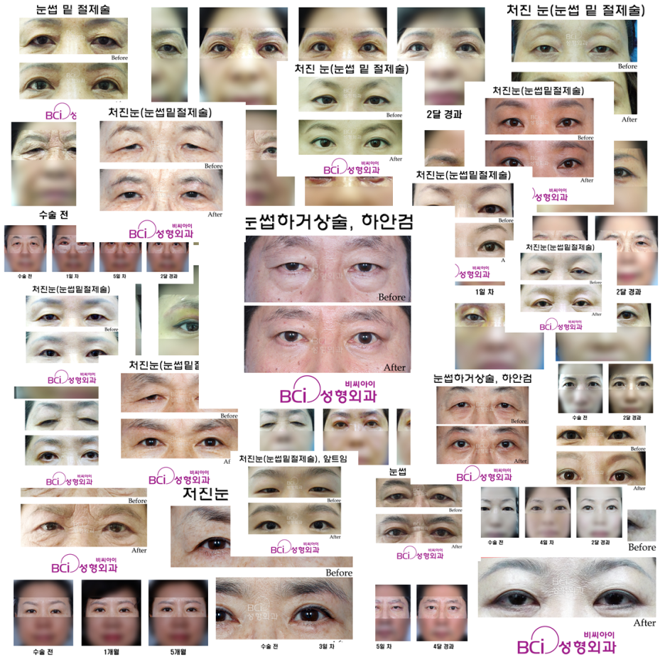 비씨아이 이미지